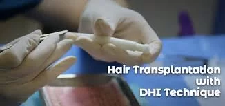 DHI Pro Hair Transplant